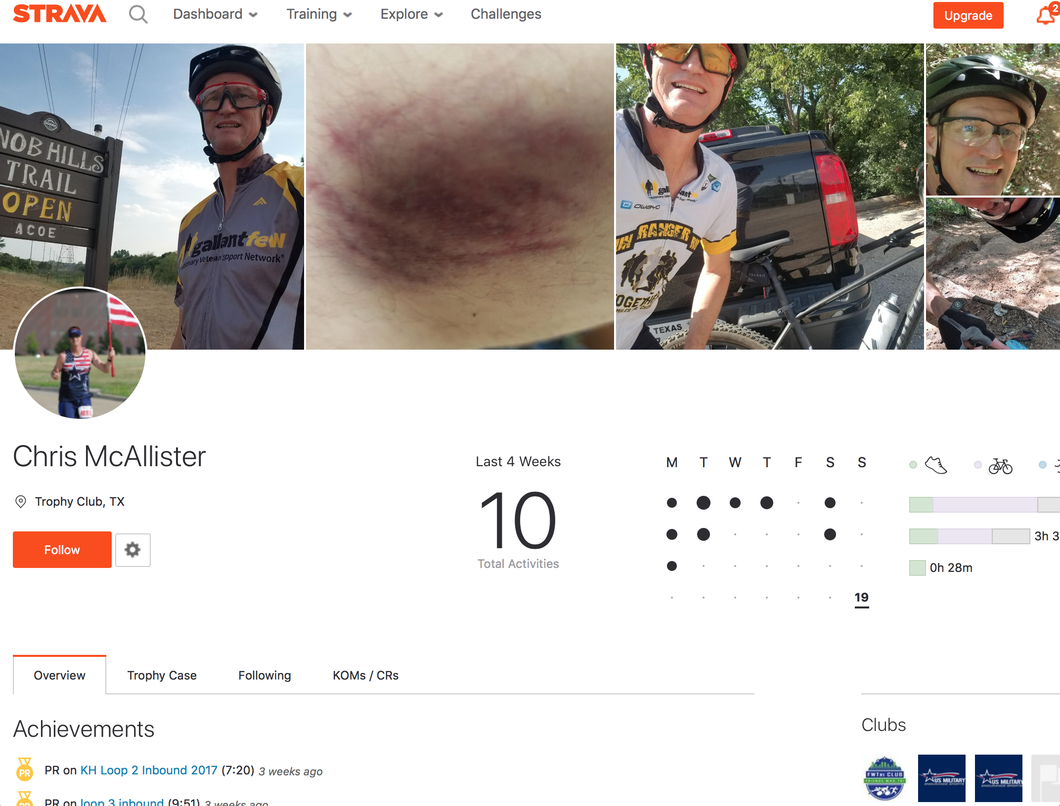 A user’s public Strava profile — activities, achievements, and a photo of the bike-crash injury that changed his training — pieced together as external research.